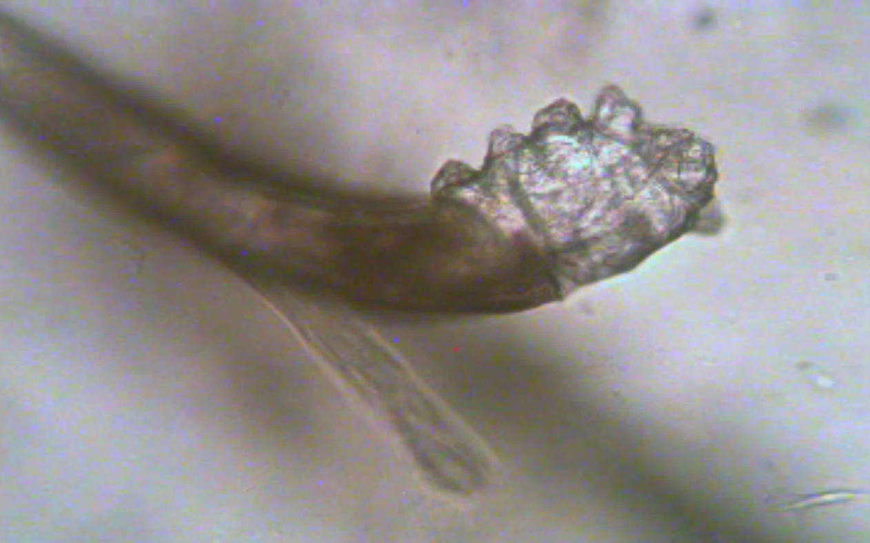 The Mighty Demodex